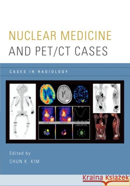 Nuclear Medicine and Pet/CT Cases Kim, Chun K. 9780199773695 Oxford University Press, USA - książka