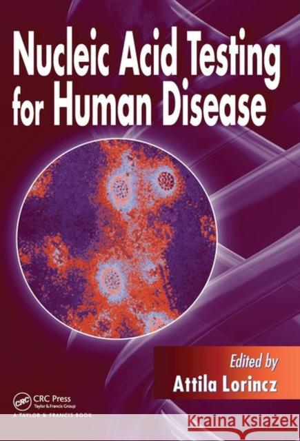 Nucleic Acid Testing for Human Disease Attila Lorincz   9780367453541 CRC Press - książka