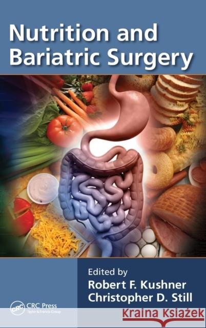 Nutrition and Bariatric Surgery Robert F. Kushner Christopher D. Still 9781466557697 CRC Press - książka