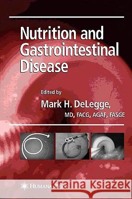 Nutrition and Gastrointestinal Disease Mark Delegge Mark Delegge 9781588298089 Humana Press - książka