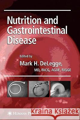 Nutrition and Gastrointestinal Disease Mark Delegge 9781617377884 Springer - książka