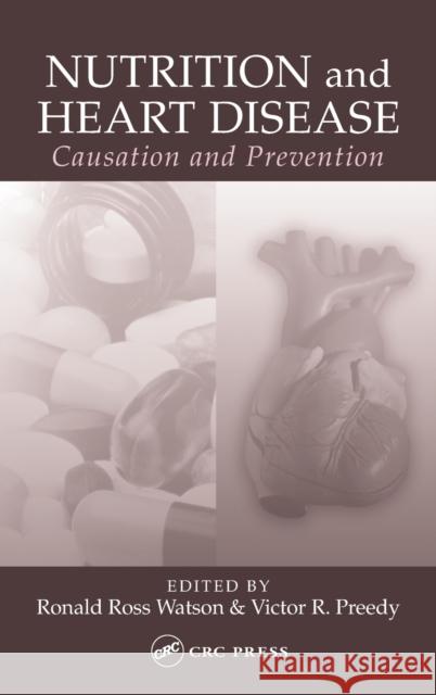 Nutrition and Heart Disease: Causation and Prevention Watson, Ronald Ross 9780849316746 CRC - książka