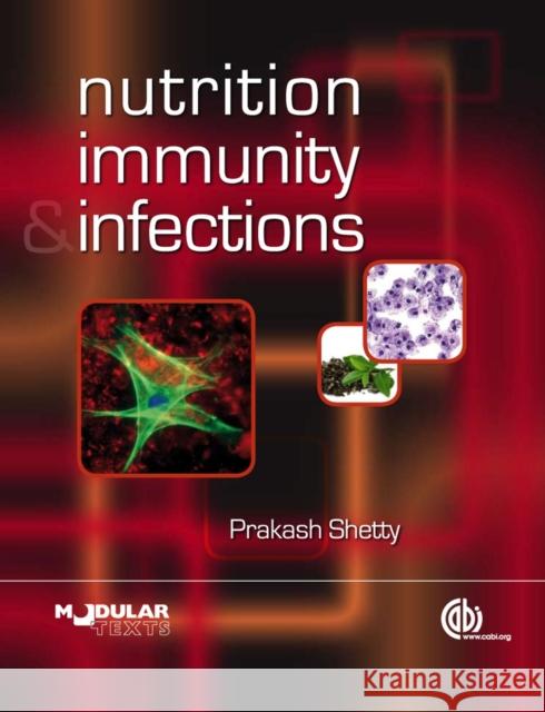 Nutrition, Immunity and Infection Prakash S Shetty 9780851995311  - książka