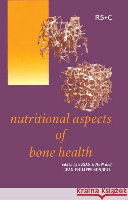 Nutritional Aspects of Bone Health   9780854045853  - książka