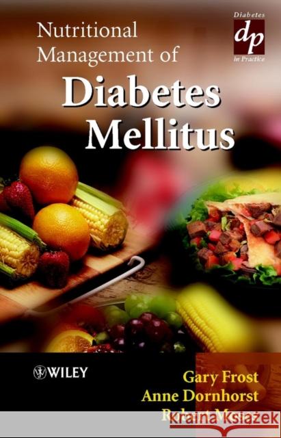 Nutritional Management of Diabetes Mellitus Gary Frost Anne Dornhorst Robert Moses 9780471497516 John Wiley & Sons - książka