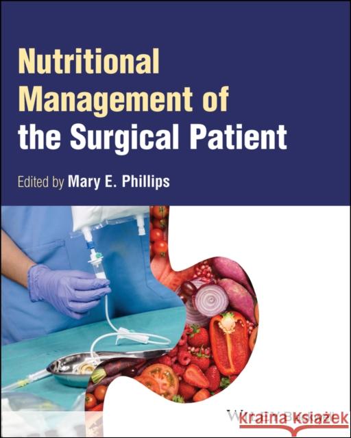 Nutritional Management of the Surgical Patient Phillips 9781119809098 John Wiley and Sons Ltd - książka