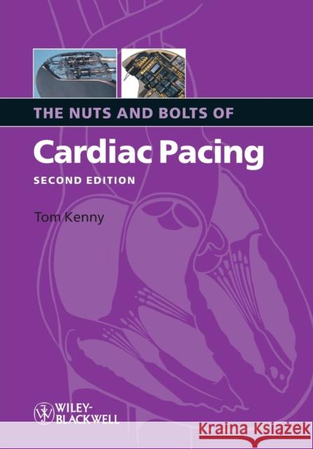 Nuts Bolts Cardiac Pacing 2e Kenny 9781405184038 Blackwell Publishers - książka