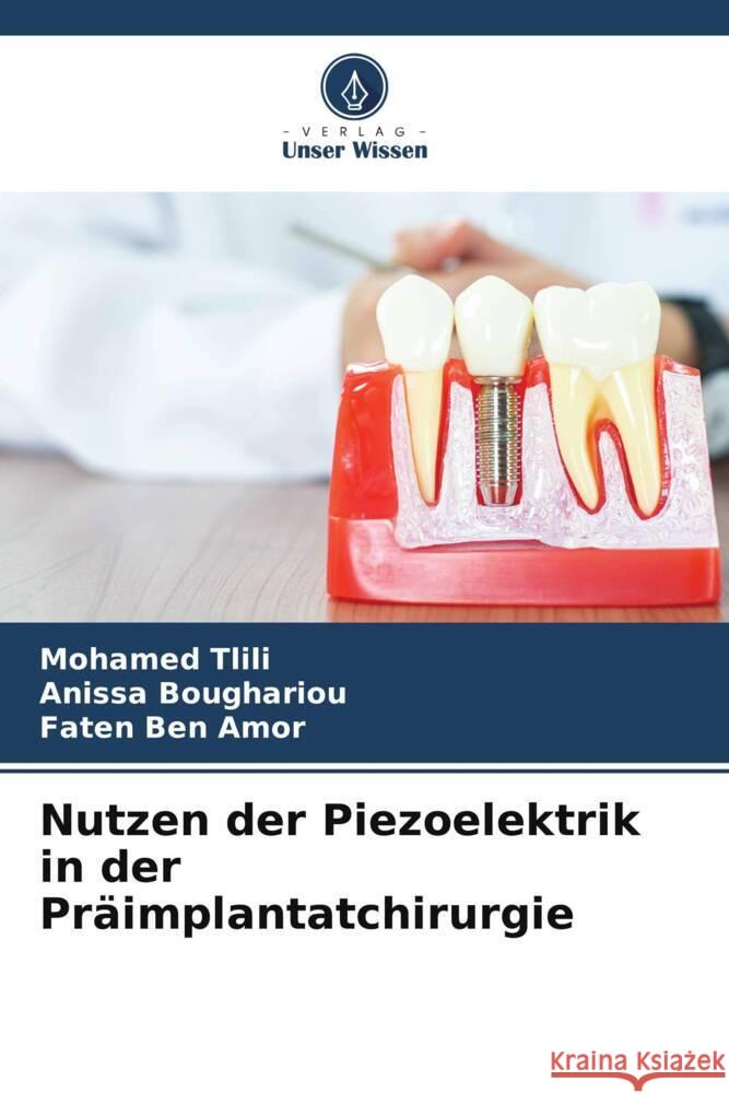 Nutzen der Piezoelektrik in der Pr?implantatchirurgie Mohamed Tlili Anissa Boughariou Faten Be 9786207162581 Verlag Unser Wissen - książka