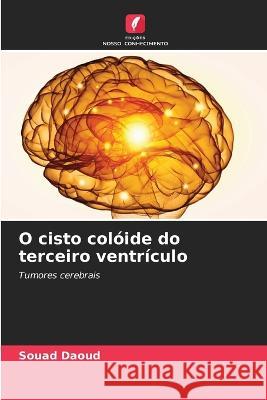 O cisto colóide do terceiro ventrículo Souad Daoud 9786205389577 Edicoes Nosso Conhecimento - książka