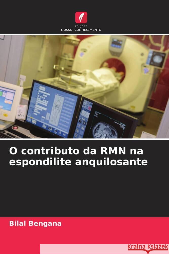 O contributo da RMN na espondilite anquilosante Bengana, Bilal 9786207115600 Edições Nosso Conhecimento - książka