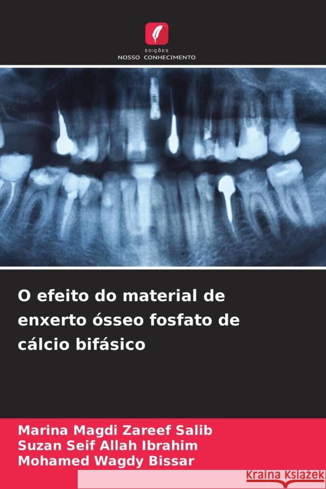 O efeito do material de enxerto ósseo fosfato de cálcio bifásico Magdi Zareef Salib, Marina, Seif Allah Ibrahim, Suzan, Wagdy Bissar, Mohamed 9786205440643 Edições Nosso Conhecimento - książka