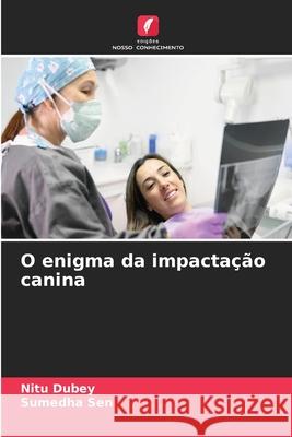 O enigma da impactação canina Dubey, Nitu, Sen, Sumedha 9786208676742 Edições Nosso Conhecimento - książka