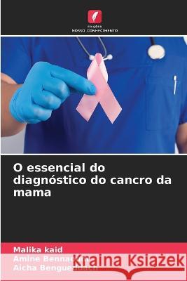 O essencial do diagnostico do cancro da mama Malika Kaid Amine Bennaoum Aicha Bengueddach 9786205707166 Edicoes Nosso Conhecimento - książka