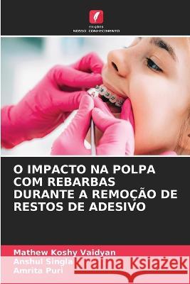 O Impacto Na Polpa Com Rebarbas Durante a Remocao de Restos de Adesivo Mathew Koshy Vaidyan Anshul Singla Amrita Puri 9786205787717 Edicoes Nosso Conhecimento - książka