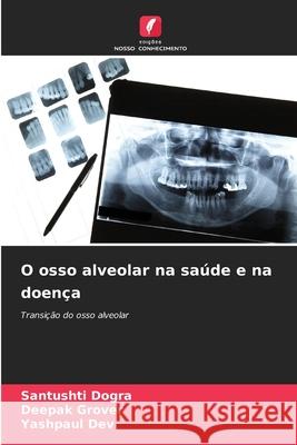 O osso alveolar na saúde e na doença Dogra, Santushti, Grover, Deepak, Dev, Yashpaul 9786209473067 Edições Nosso Conhecimento - książka