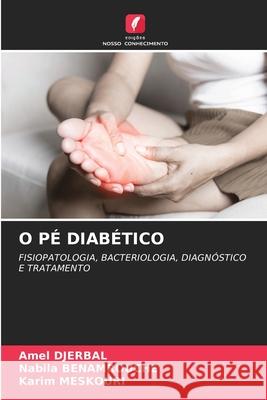 O P? Diab?tico Amel Djerbal Nabila Benamrouche Karim Meskouri 9786207530410 Edicoes Nosso Conhecimento - książka