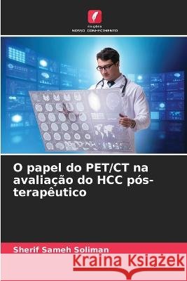 O papel do PET/CT na avalia??o do HCC p?s-terap?utico Sherif Same 9786205743690 Edicoes Nosso Conhecimento - książka