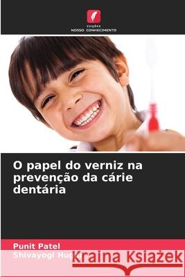 O papel do verniz na preven??o da c?rie dent?ria Punit Patel Shivayogi Hugar 9786207625567 Edicoes Nosso Conhecimento - książka