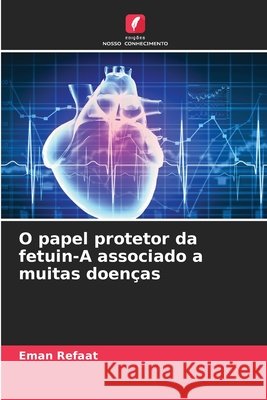 O papel protetor da fetuin-A associado a muitas doenças Refaat, Eman 9786209472411 Edições Nosso Conhecimento - książka