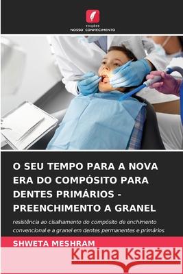 O Seu Tempo Para a Nova Era Do Compósito Para Dentes Primários - Preenchimento a Granel Shweta Meshram 9786204097350 Edicoes Nosso Conhecimento - książka