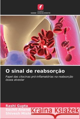 O sinal de reabsorção Gupta, Rashi, Arora, Sachit Anand, Mishra, Shivesh 9786208458799 Edições Nosso Conhecimento - książka