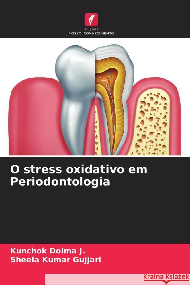 O stress oxidativo em Periodontologia Dolma J., Kunchok, Gujjari, Sheela kumar 9786205080924 Edições Nosso Conhecimento - książka