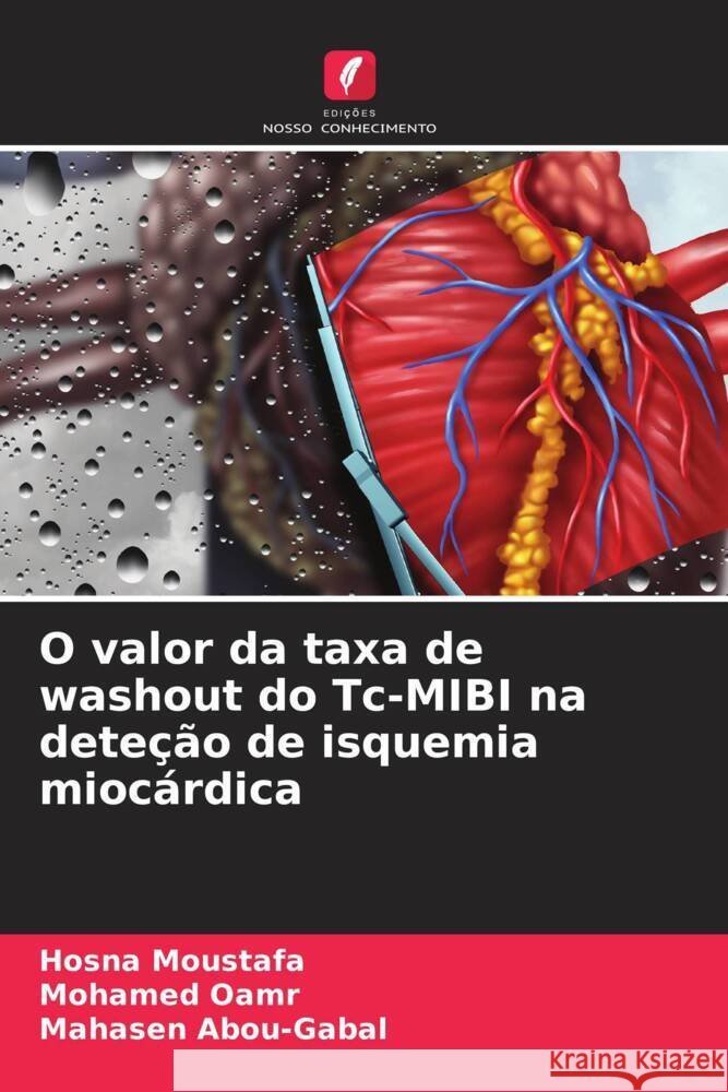 O valor da taxa de washout do Tc-MIBI na dete??o de isquemia mioc?rdica Hosna Moustafa Mohamed Oamr Mahasen Abou-Gabal 9786206903048 Edicoes Nosso Conhecimento - książka