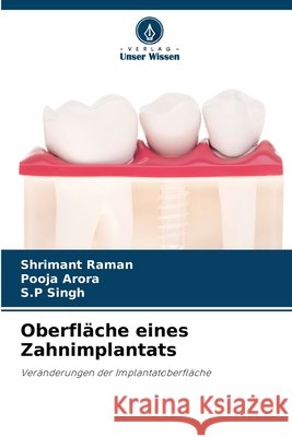 Oberfl?che eines Zahnimplantats Shrimant Raman Pooja Arora S. P. Singh 9786630296518 Verlag Unser Wissen - książka