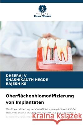 Oberflächenbiomodifizierung von Implantaten V, DHEERAJ, Hegde, Shashikanth, KS, RAJESH 9786209368455 Verlag Unser Wissen - książka