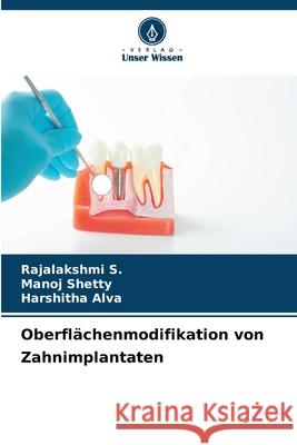 Oberfl?chenmodifikation von Zahnimplantaten Rajalakshmi S Manoj Shetty Harshitha Alva 9786207755097 Verlag Unser Wissen - książka