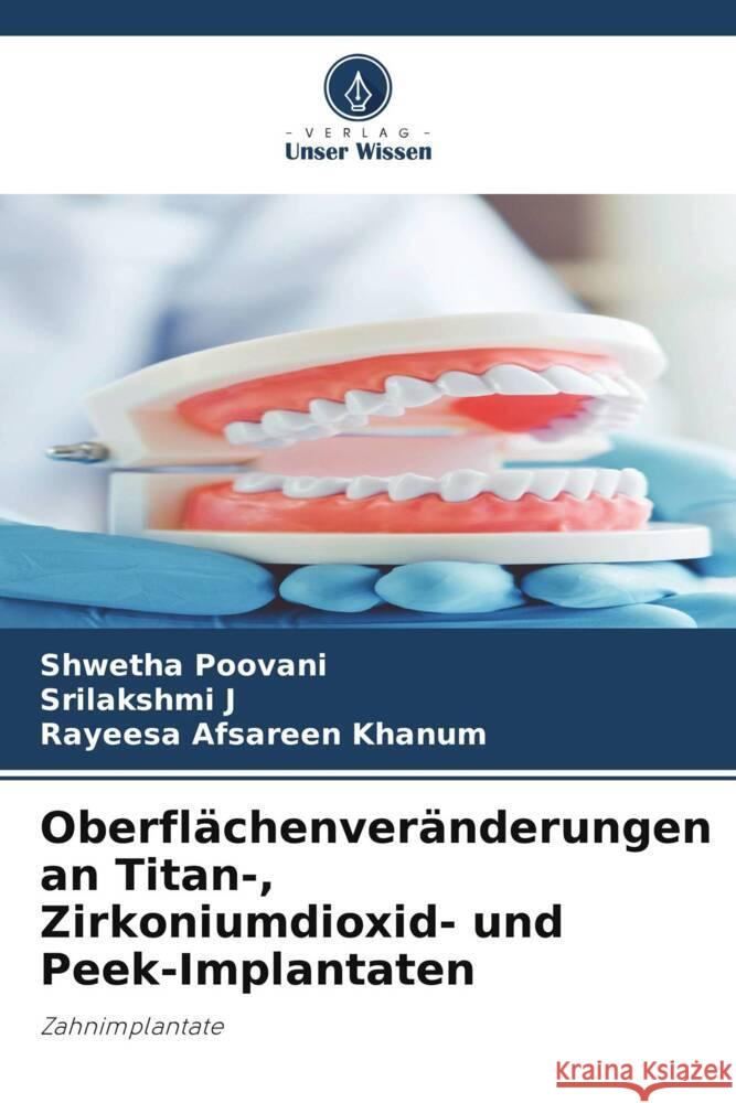 Oberflächenveränderungen an Titan-, Zirkoniumdioxid- und Peek-Implantaten Poovani, Shwetha, J, Srilakshmi, Khanum, Rayeesa Afsareen 9786207083695 Verlag Unser Wissen - książka