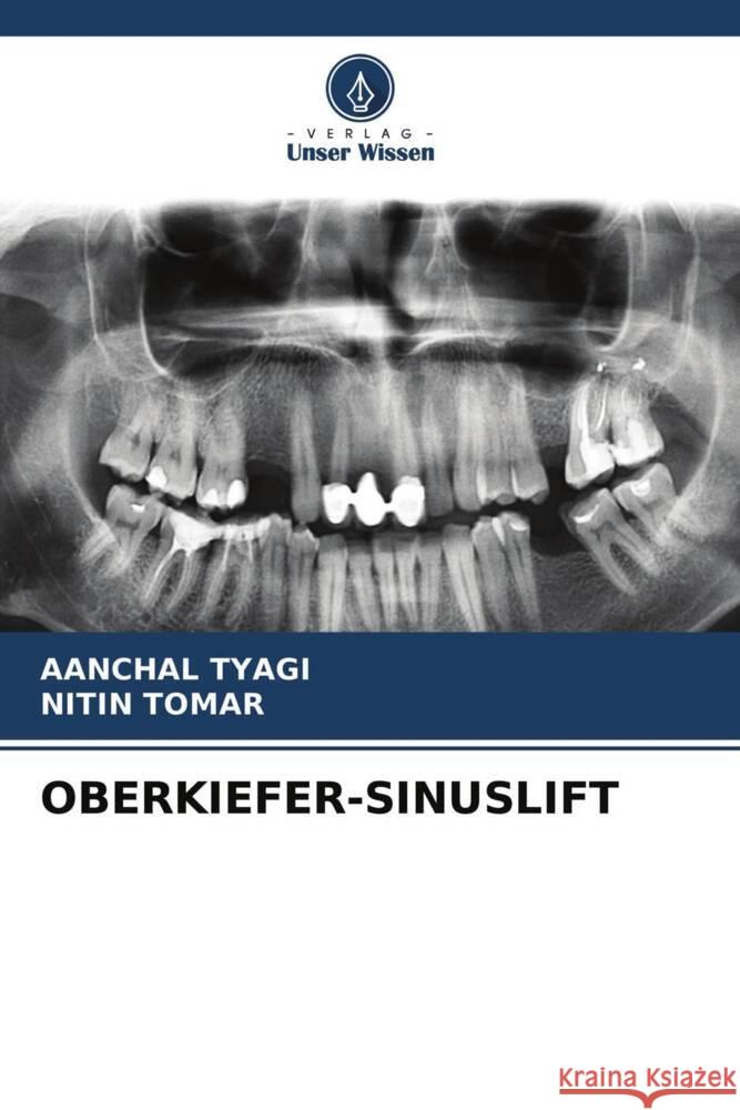 OBERKIEFER-SINUSLIFT Tyagi, Aanchal, Tomar, Nitin 9786204226309 Verlag Unser Wissen - książka