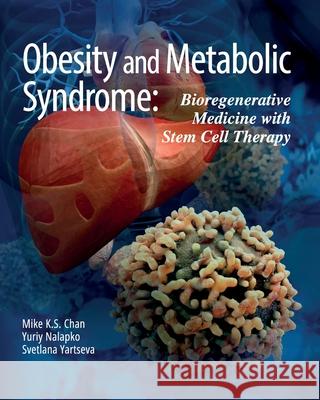 Obesity and Metabolic Syndrome: Bioregenerative Medicine with Stem Cell Therapy Mike K. S. Chan Yuriy Nalapko Svetlana Yartseva 9781662927188 European Wellness Academy - książka