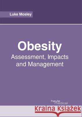 Obesity: Assessment, Impacts and Management Luke Mosley 9781632415462 Hayle Medical - książka
