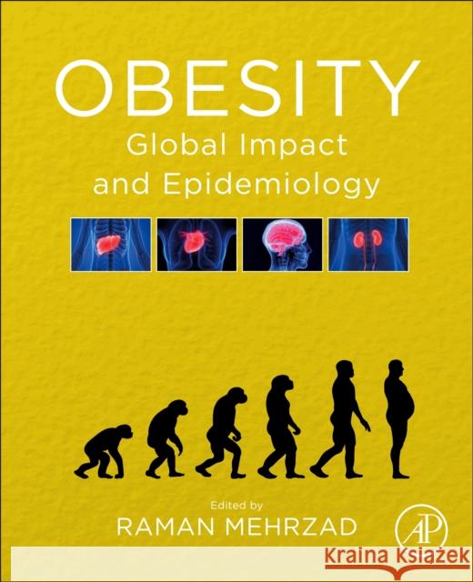 Obesity: Global Impact and Epidemiology Raman Mehrzad 9780128188392 Elsevier - książka