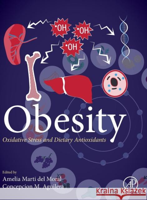 Obesity: Oxidative Stress and Dietary Antioxidants Marti, Amelia 9780128125045 Academic Press - książka