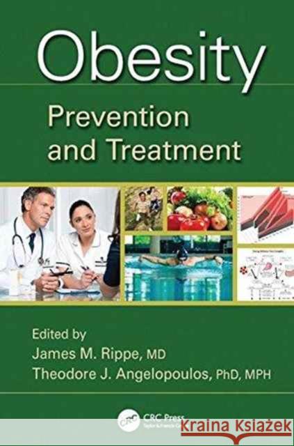 Obesity: Prevention and Treatment James M. Rippe (Professor of Medicine, University of Massachusetts Medical School), Theodore J. Angelopoulos (University 9781138198494 Taylor & Francis Ltd - książka