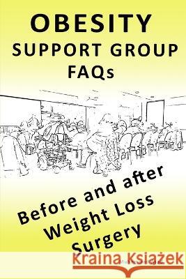 OBESITY SUPPORT GROUP FAQs: Before and After Weight Loss Surgery Muhammad Asad   9781733506861 Medicalfronts Consultancy - książka