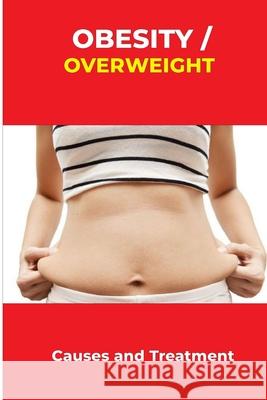 Obesity/overweight: Causes and Treatment Sam Anderson   9798362075859 Independently Published - książka