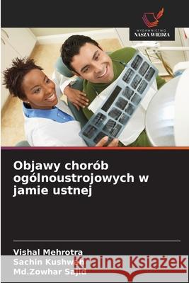 Objawy chorób ogólnoustrojowych w jamie ustnej Mehrotra, Vishal, Kushwah, Sachin, Sajid, Md.Zowhar 9786209150760 Wydawnictwo Nasza Wiedza - książka