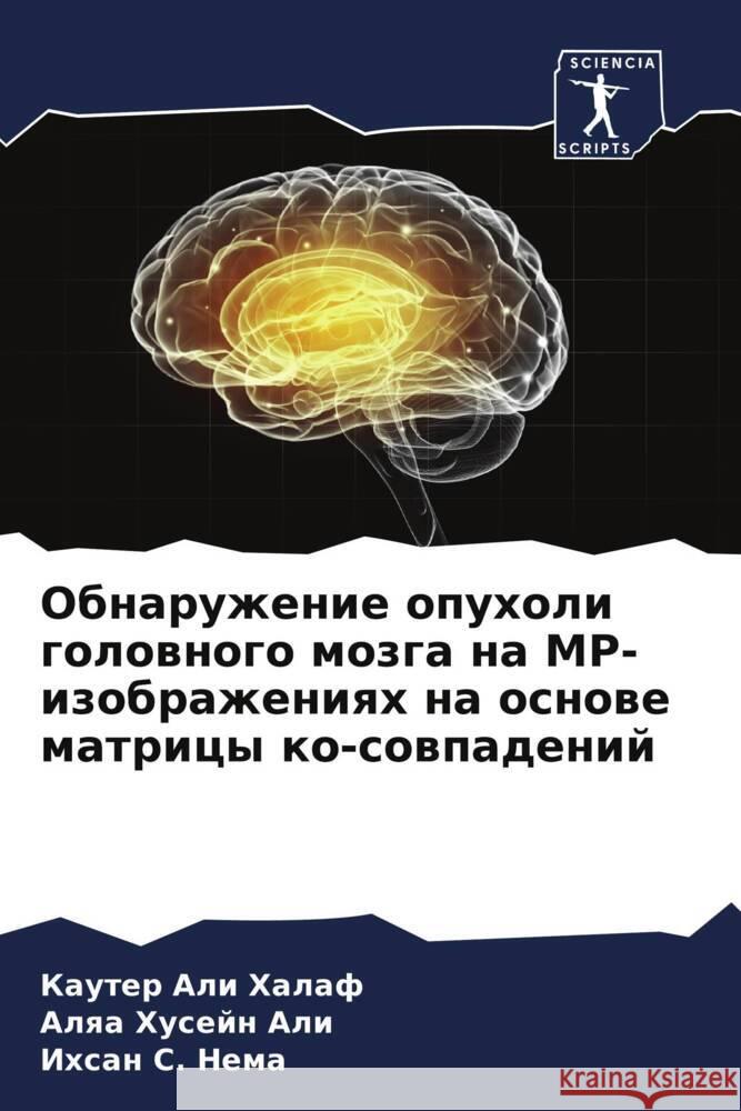 Obnaruzhenie opuholi golownogo mozga na MR-izobrazheniqh na osnowe matricy ko-sowpadenij Halaf, Kauter Ali, Ali, Alqa Husejn, Nema, Ihsan S. 9786204900575 Sciencia Scripts - książka