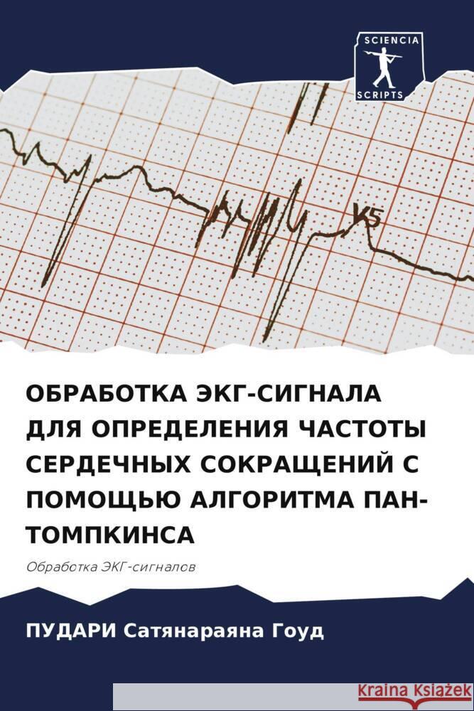 OBRABOTKA JeKG-SIGNALA DLYa OPREDELENIYa ChASTOTY SERDEChNYH SOKRAShhENIJ S POMOShh'Ju ALGORITMA PAN-TOMPKINSA Satqnaraqna Goud, PUDARI 9786206329961 Sciencia Scripts - książka