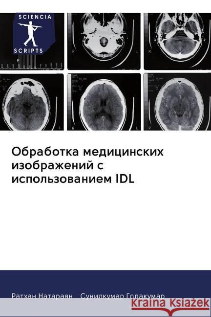 Obrabotka medicinskih izobrazhenij s ispol'zowaniem IDL Nataraqn, Rathan; Gopakumar, Sunilkumar 9786202566551 Sciencia Scripts - książka