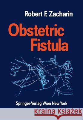 Obstetric Fistula Robert F. Zacharin Otto Kaser 9783709189238 Springer - książka