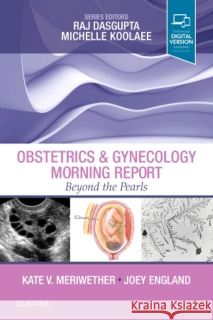 Obstetrics & Gynecology Morning Report: Beyond the Pearls Kate V. Meriwether Joey England 9780323496131 Elsevier - książka