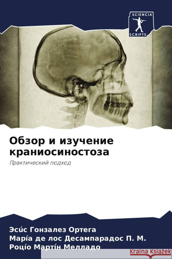 Obzor i izuchenie kraniosinostoza Ortega, Jesús Gonzalez, M., María de los Desamparados P., Mellado, Rocío Martín 9786205421550 Sciencia Scripts - książka