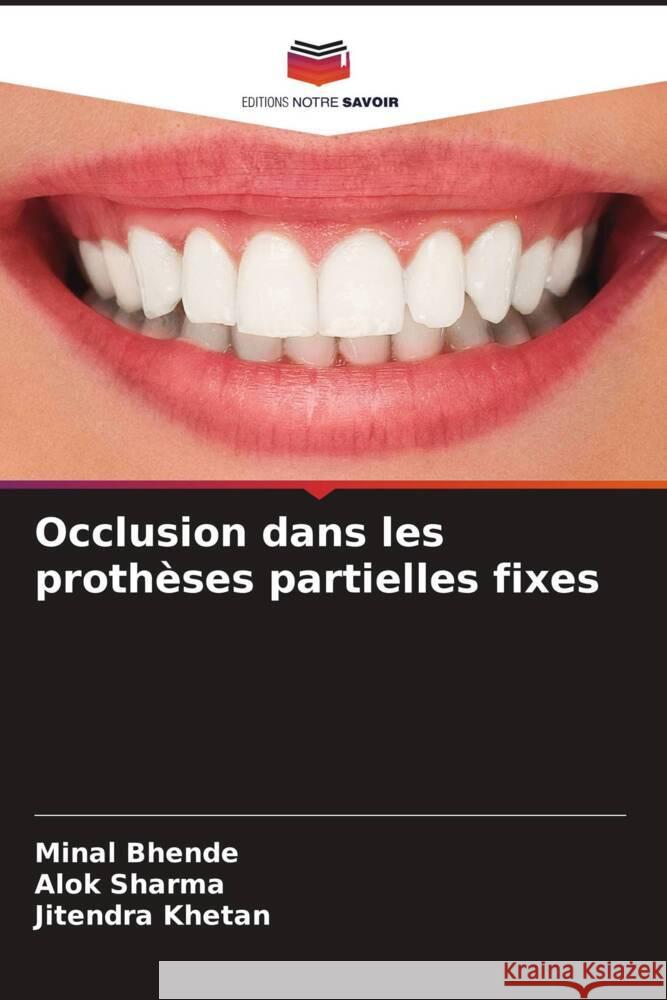 Occlusion dans les proth?ses partielles fixes Minal Bhende Alok Sharma Jitendra Khetan 9786207234714 Editions Notre Savoir - książka