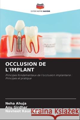 OCCLUSION DE L'IMPLANT Ahuja, Neha, Girdhar, ANU, Kaur Mann, Navneet 9786208715717 Editions Notre Savoir - książka