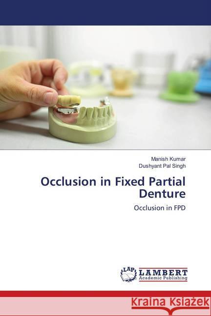 Occlusion in Fixed Partial Denture : Occlusion in FPD Kumar, Manish; Singh, Dushyant Pal 9786138385684 LAP Lambert Academic Publishing - książka