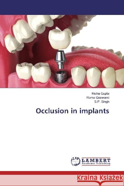 Occlusion in implants Gupta, Richa; Goswami, Roma; Singh, S. P. 9783659932823 LAP Lambert Academic Publishing - książka